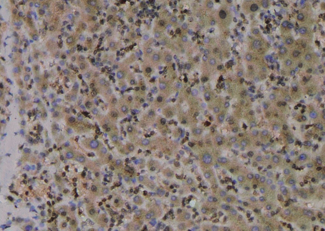 Phospho-TBC1D1 (Ser627) Antibody in Immunohistochemistry (Paraffin) (IHC (P))