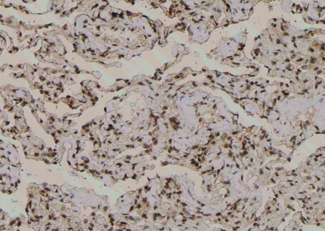 Phospho-TBC1D1 (Ser627) Antibody in Immunohistochemistry (Paraffin) (IHC (P))