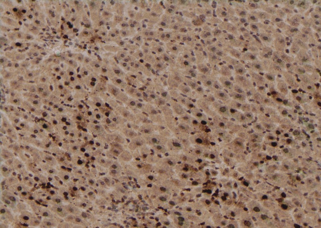 Phospho-TBC1D1 (Ser627) Antibody in Immunohistochemistry (Paraffin) (IHC (P))