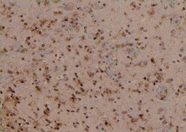 Phospho-TBC1D1 (Ser627) Antibody in Immunohistochemistry (Paraffin) (IHC (P))