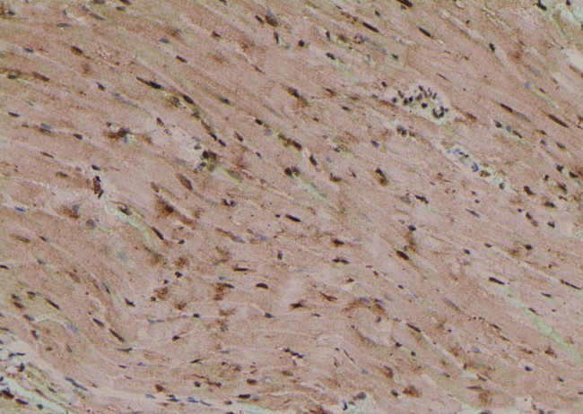 Phospho-TBC1D1 (Ser627) Antibody in Immunohistochemistry (Paraffin) (IHC (P))