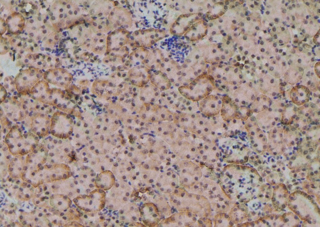 Phospho-RICTOR (Ser1591) Antibody in Immunohistochemistry (Paraffin) (IHC (P))