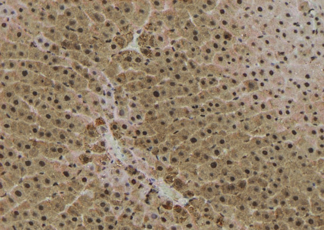 Phospho-RICTOR (Ser1591) Antibody in Immunohistochemistry (Paraffin) (IHC (P))