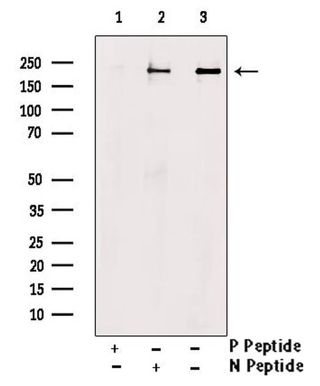 Phospho-RICTOR (Ser1591) Antibody in Western Blot (WB)