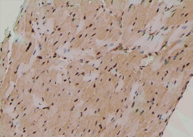 Phospho-ATG14 (Thr429) Antibody in Immunohistochemistry (Paraffin) (IHC (P))