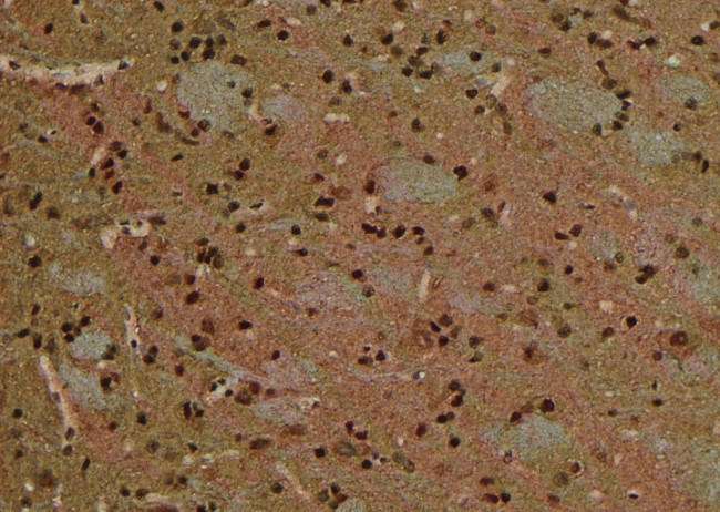 Phospho-ATG14 (Thr429) Antibody in Immunohistochemistry (Paraffin) (IHC (P))