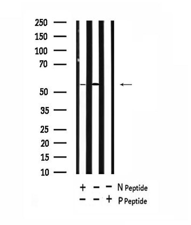 Phospho-ATG14 (Thr429) Antibody in Western Blot (WB)