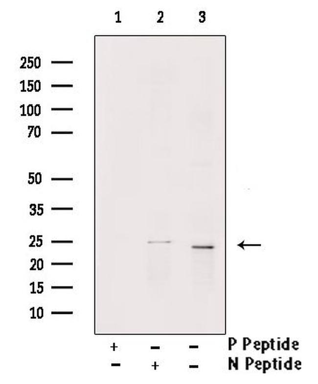 Phospho-MOB4A (Tyr26) Antibody in Western Blot (WB)