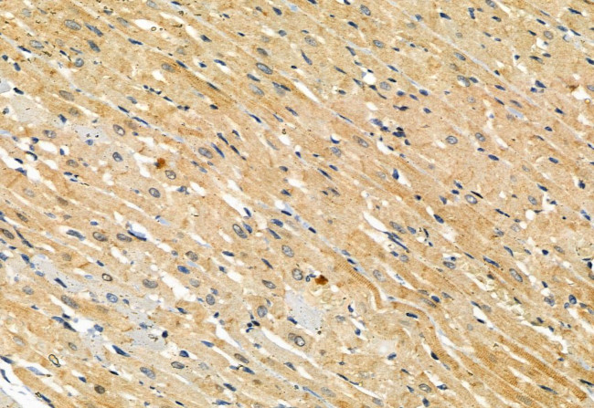 Phospho-MLKL (Ser358) Antibody in Immunohistochemistry (Paraffin) (IHC (P))