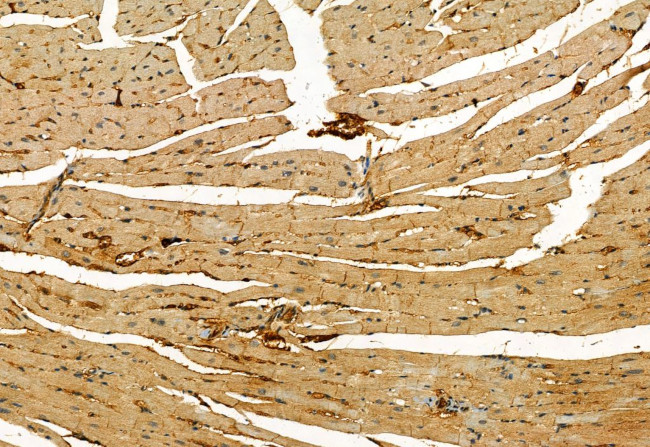 Phospho-MLKL (Ser358) Antibody in Immunohistochemistry (Paraffin) (IHC (P))