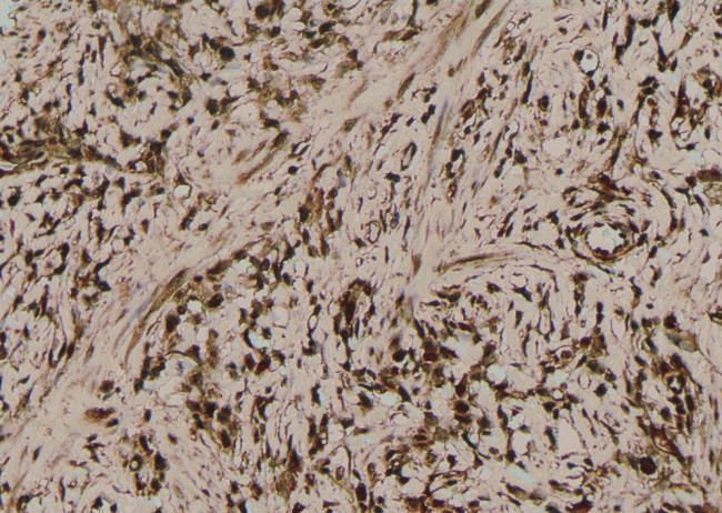 Phospho-MLKL (Ser358) Antibody in Immunohistochemistry (Paraffin) (IHC (P))