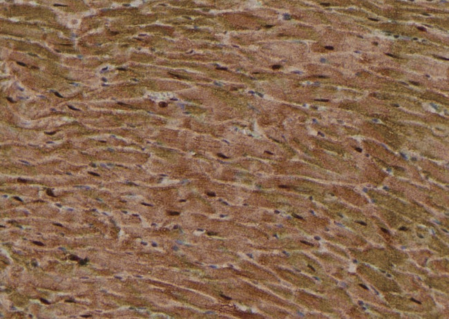 Phospho-MLKL (Ser358) Antibody in Immunohistochemistry (Paraffin) (IHC (P))