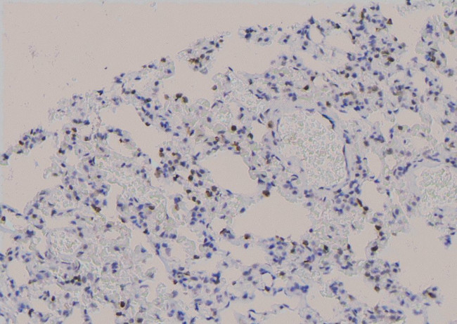 Phospho-NT5C (Ser184) Antibody in Immunohistochemistry (Paraffin) (IHC (P))