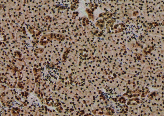 Phospho-Bad (Ser75) Antibody in Immunohistochemistry (Paraffin) (IHC (P))