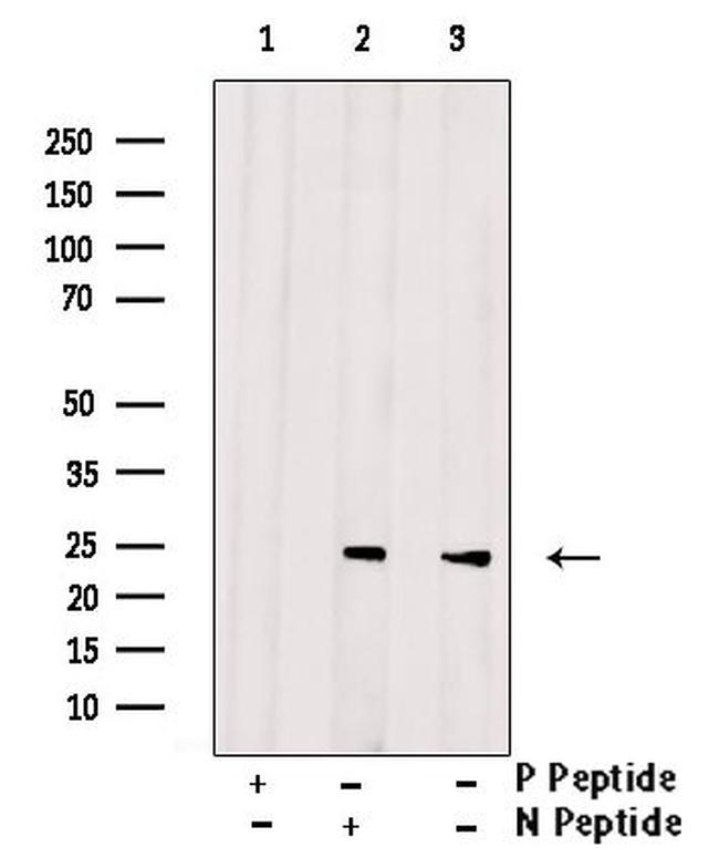 Phospho-Bad (Ser75) Antibody in Western Blot (WB)