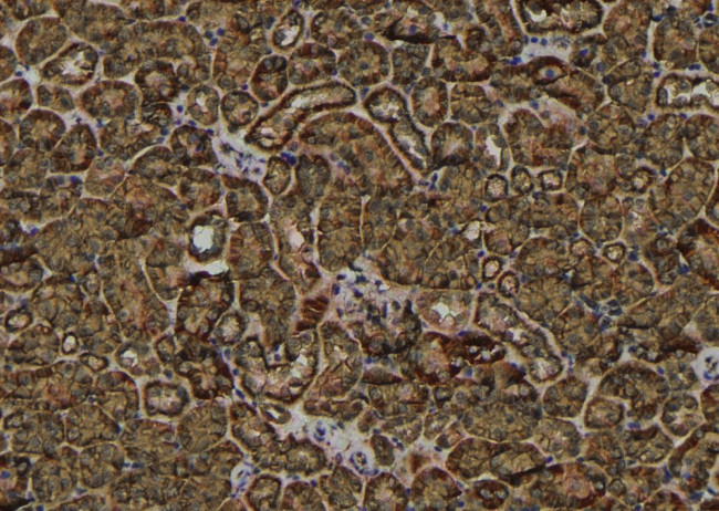 Phospho-PRAS40 (Ser212) Antibody in Immunohistochemistry (Paraffin) (IHC (P))