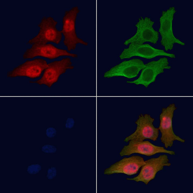 Phospho-LIN28A (Ser200) Antibody in Immunocytochemistry (ICC/IF)