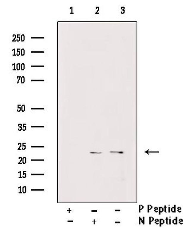 Phospho-LIN28A (Ser200) Antibody in Western Blot (WB)