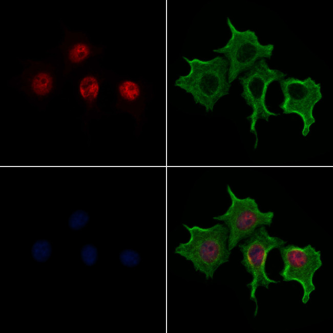 Phospho-TWIST1 (Ser68) Antibody in Immunocytochemistry (ICC/IF)