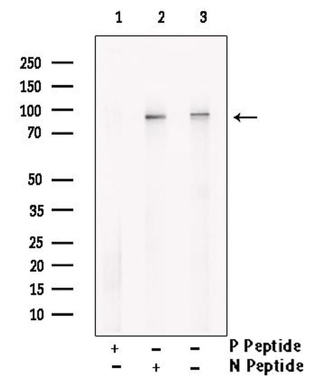 Phospho-Nephrin (Ser432) Antibody in Western Blot (WB)