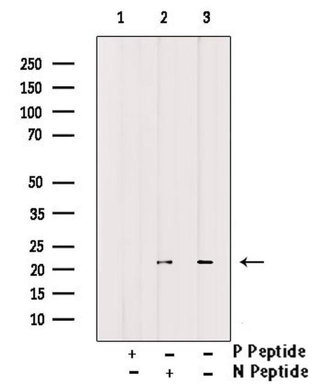 Phospho-Claudin 7 (Tyr210) Antibody in Western Blot (WB)