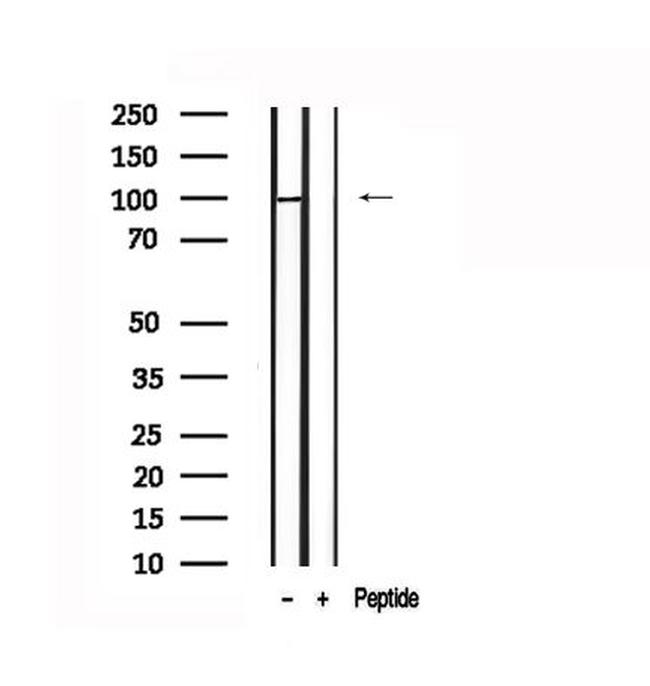 Phospho-TLR4 (Ser800) Antibody in Western Blot (WB)