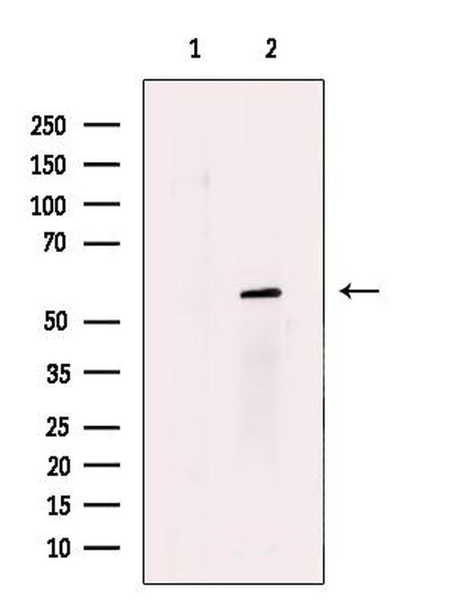 N-WASP Antibody in Western Blot (WB)