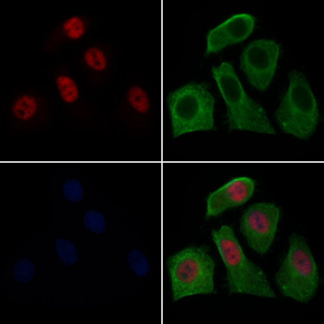 SETD8 Antibody in Immunocytochemistry (ICC/IF)