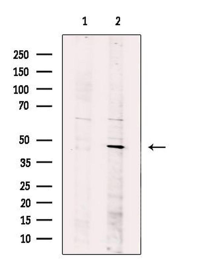 SETD8 Antibody in Western Blot (WB)