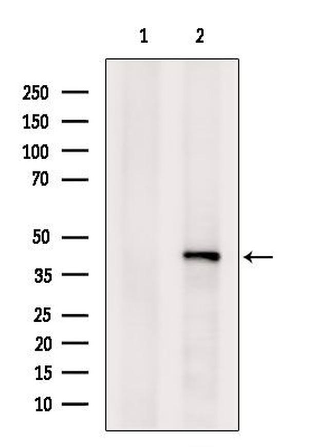 SETD8 Antibody in Western Blot (WB)