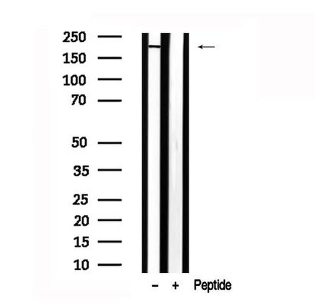 KIF1B Antibody in Western Blot (WB)