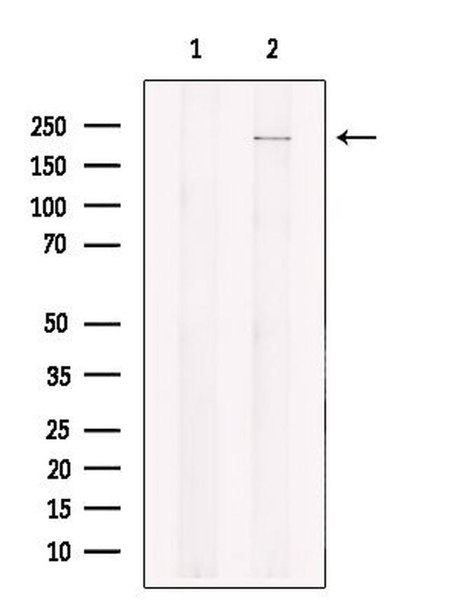 KIF1B Antibody in Western Blot (WB)