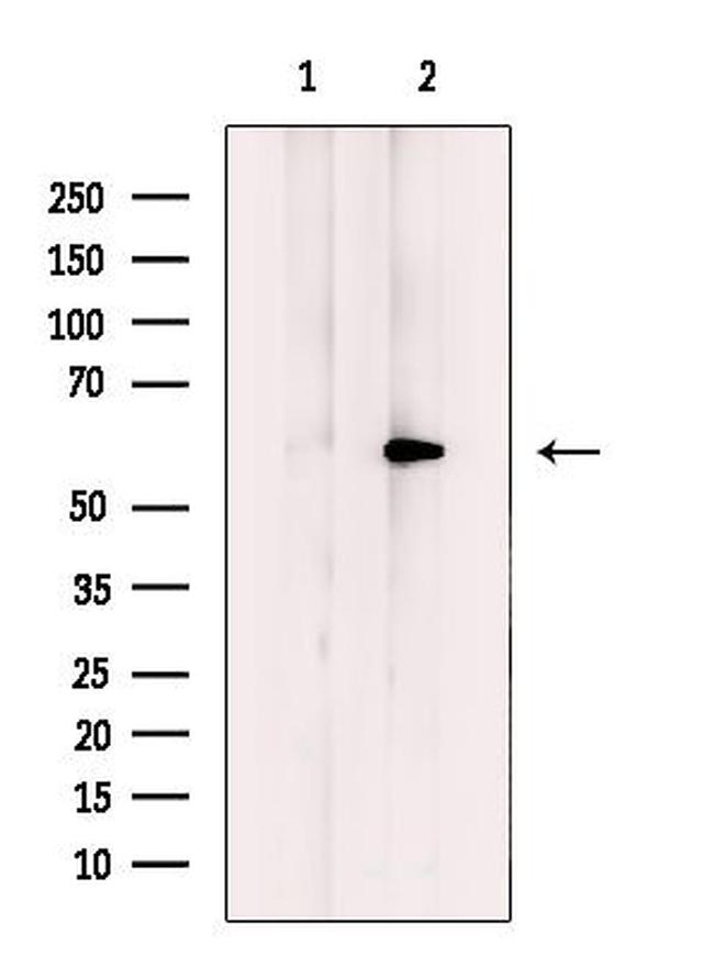 HBP1 Antibody in Western Blot (WB)