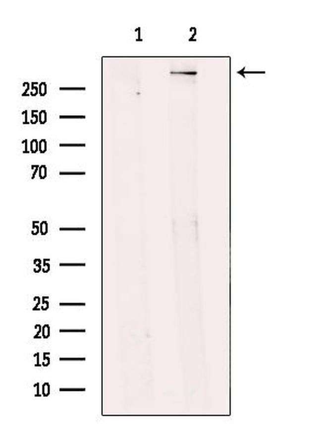 BRCA2 Antibody in Western Blot (WB)