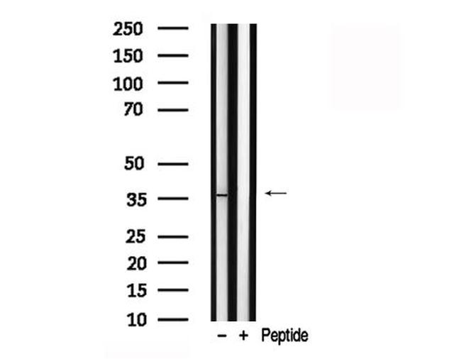 Ephrin B2 Antibody in Western Blot (WB)