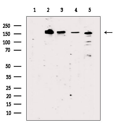 BCL9L Antibody in Western Blot (WB)