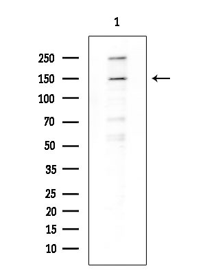 BCL9L Antibody in Western Blot (WB)