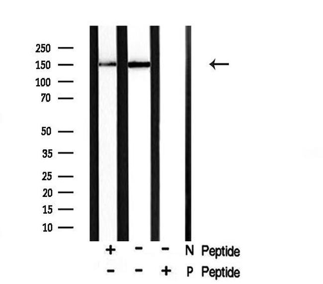 Phospho-TYK2 (Tyr1054) Antibody in Western Blot (WB)