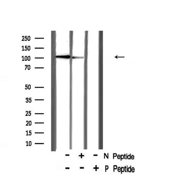 Phospho-CtIP (Ser327) Antibody in Western Blot (WB)