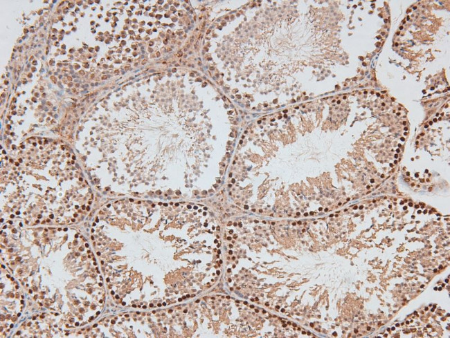 Phospho-DNA-PK (Thr2609) Antibody in Immunohistochemistry (Paraffin) (IHC (P))