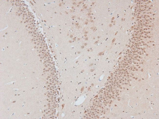 Phospho-DNA-PK (Thr2609) Antibody in Immunohistochemistry (Paraffin) (IHC (P))