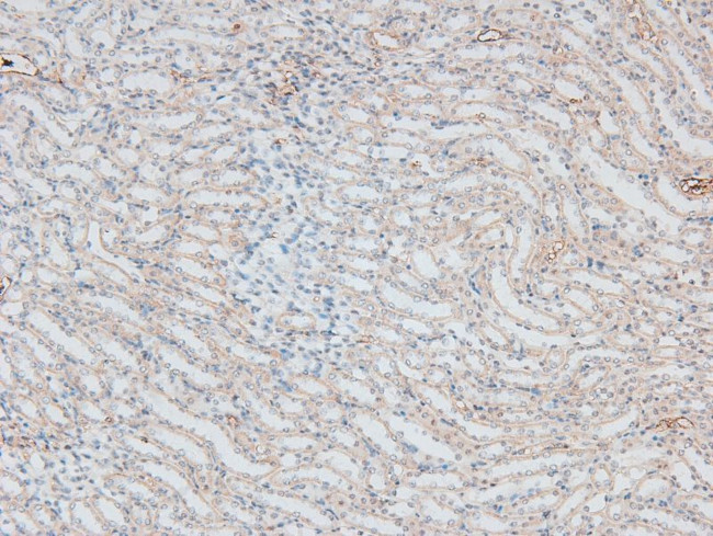 Phospho-IRAK1 (Thr387) Antibody in Immunohistochemistry (Paraffin) (IHC (P))