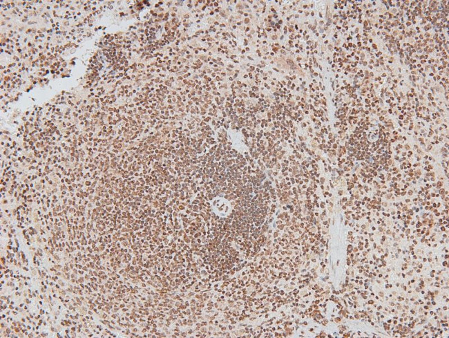 Phospho-IRAK1 (Thr387) Antibody in Immunohistochemistry (Paraffin) (IHC (P))