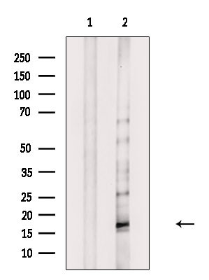 Phospho-MYL9 (Thr19, Ser20) Antibody in Western Blot (WB)