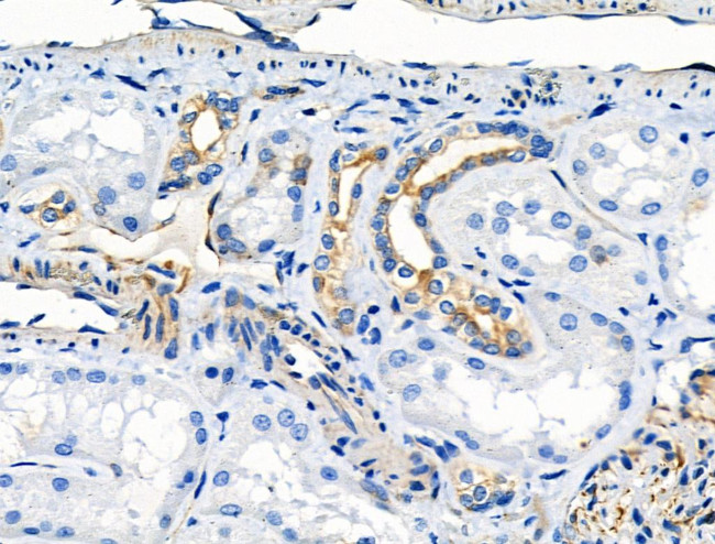 Phospho-NFATC2 (Ser326) Antibody in Immunohistochemistry (Paraffin) (IHC (P))