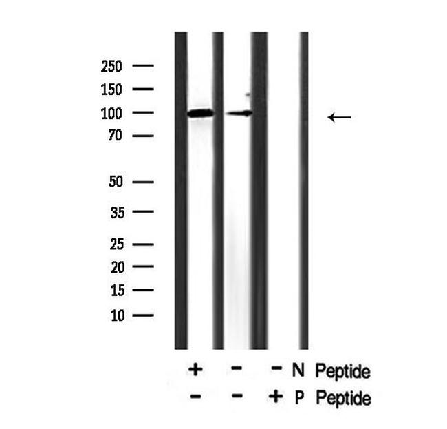 Phospho-NFATC2 (Ser326) Antibody in Western Blot (WB)