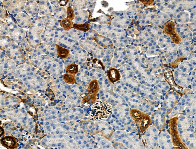 Phospho-NFATC1 (Ser294) Antibody in Immunohistochemistry (Paraffin) (IHC (P))