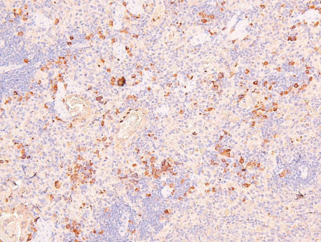 Phospho-NFkB p105 (Ser923) Antibody in Immunohistochemistry (Paraffin) (IHC (P))