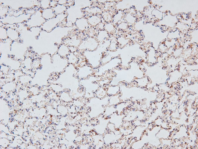 Phospho-NFkB p105 (Ser923) Antibody in Immunohistochemistry (Paraffin) (IHC (P))