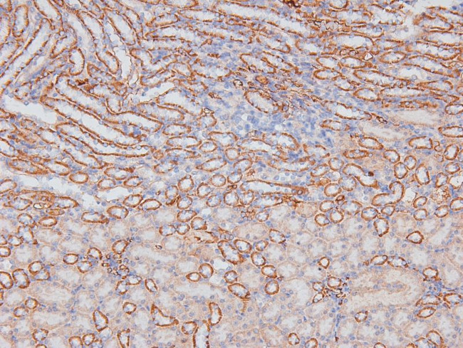 Phospho-NFkB p105 (Ser923) Antibody in Immunohistochemistry (Paraffin) (IHC (P))